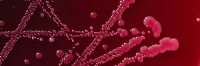 Advances in Clostridioides difficile Diagnosis and Surveillance in Clinical Microbiology