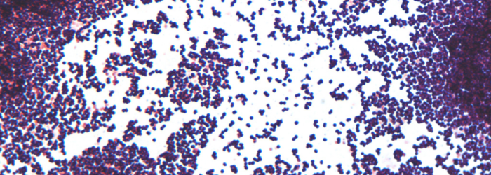 Peptostreptococcus anaerobius gram stain