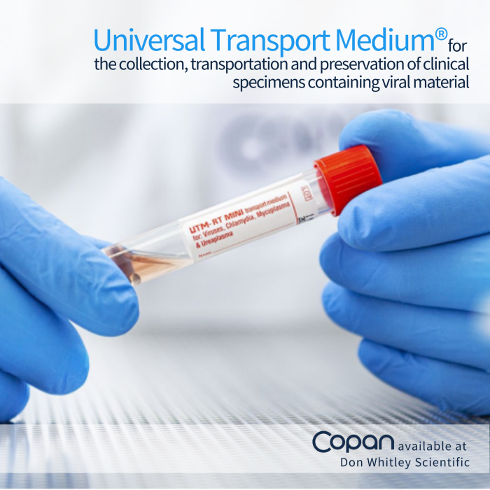 Monkeypox virus: sample collection and transportation