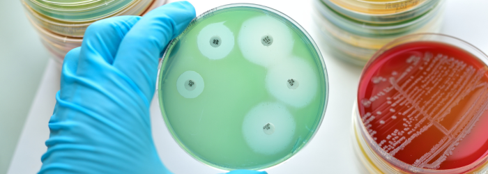 Antimicrobial Susceptibility Testing