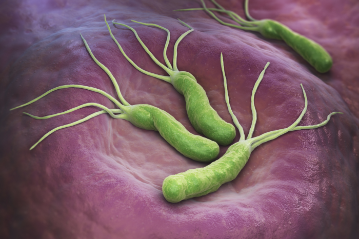 Perfect Workstation For Your Helicobacter Pylori